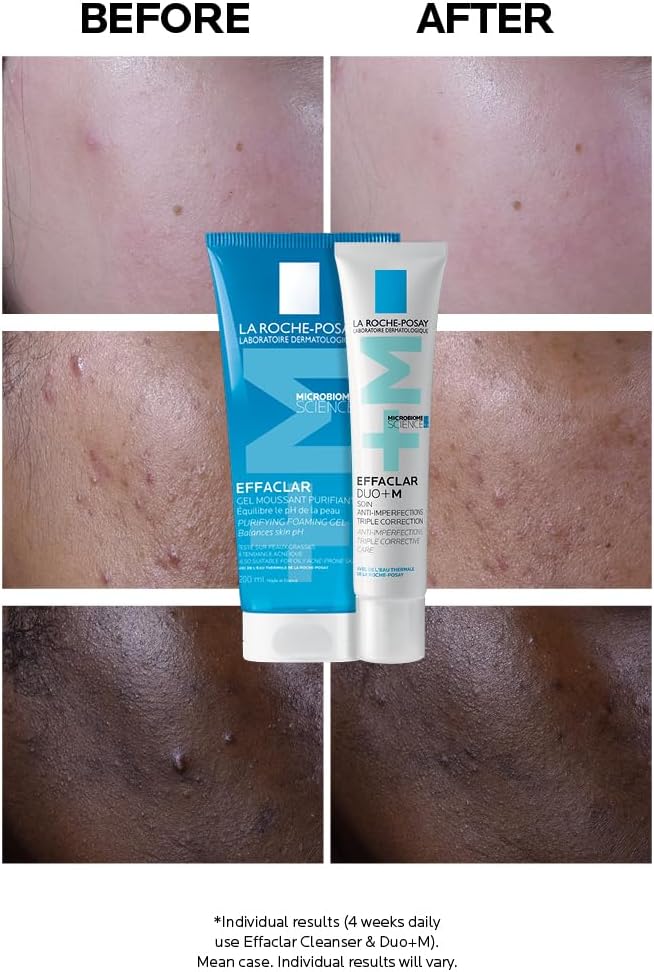 La Roche-Posay Effaclar Duo+M Anti-Breakout Gel – 40ml
