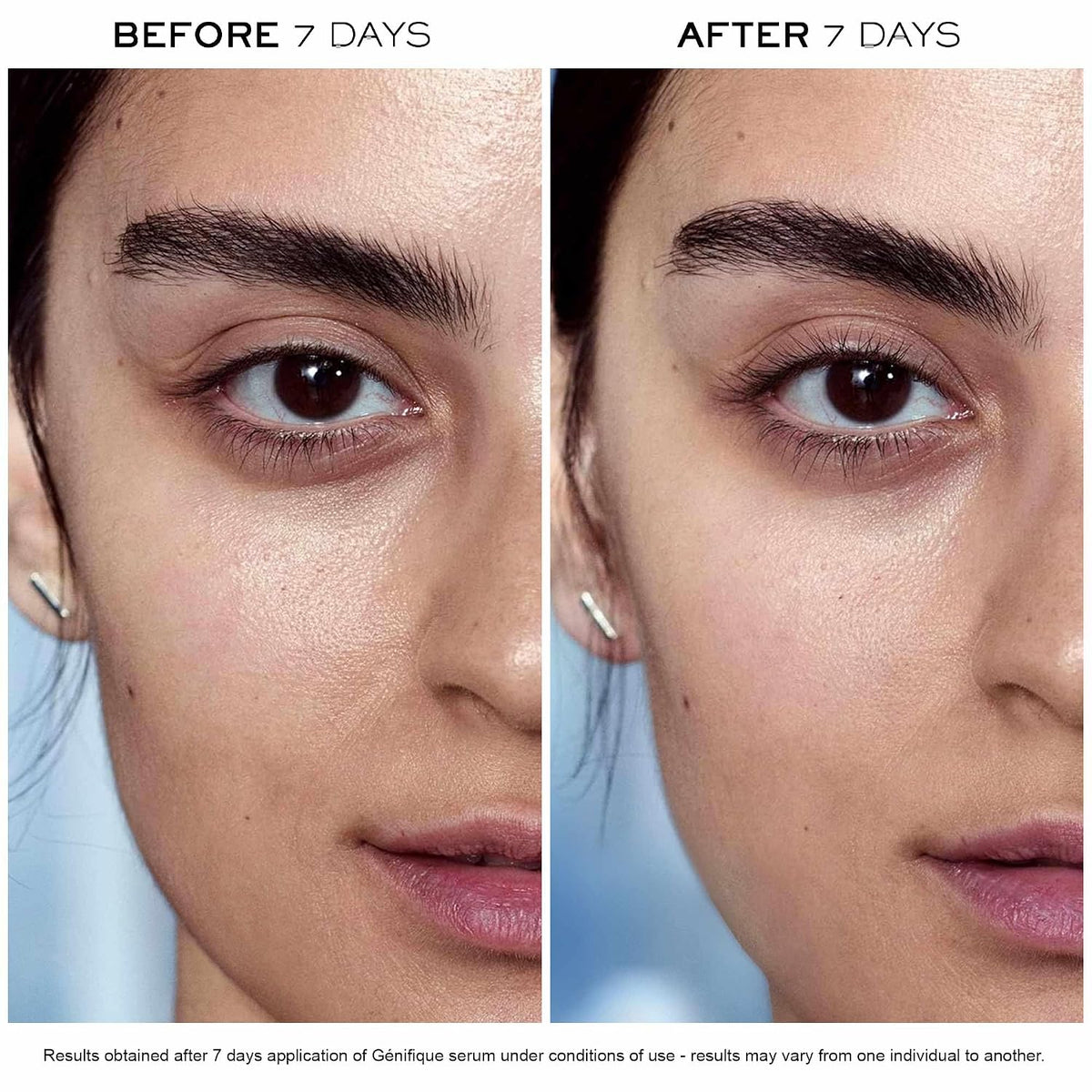 Lancôme Advanced Génifique Anti-Aging Face Serum – Hydrates